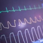 Heart ablation cuts irregular beats, but may not make patients feel better | India News