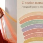 “Layers of Life”, gown designed by Keesha Abdallah is inspired by 7 anatomical layers involved in a Caesarean section