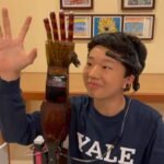 Meet Benjamin Choi, a 17-year-old who built a $300 mind-controlled prosthetic arm that reads brainwaves through non-invasive electrodes