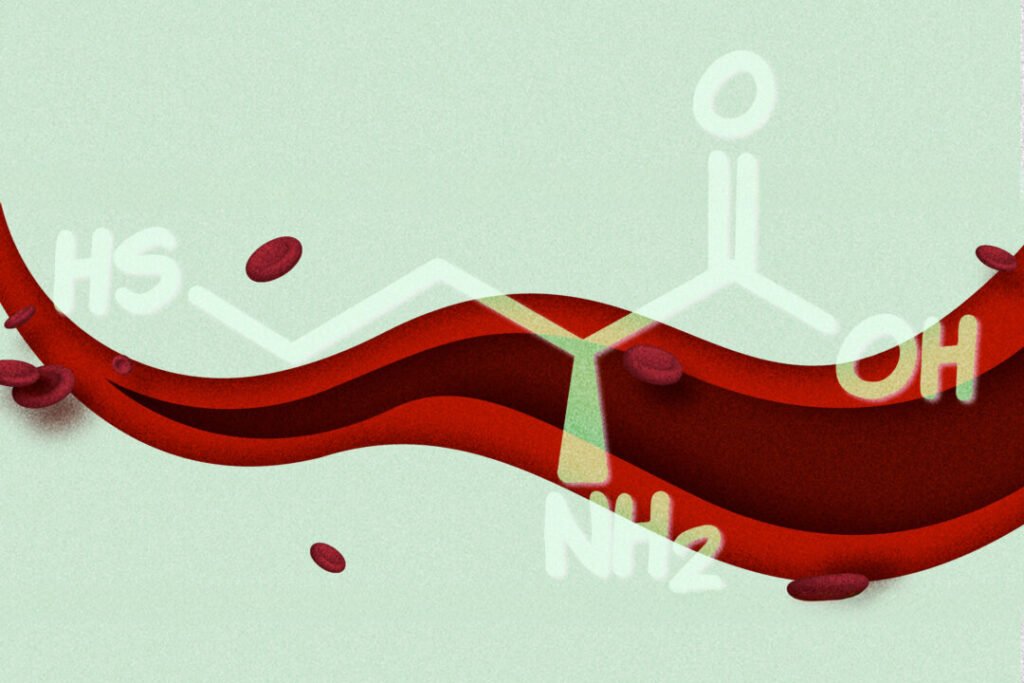 High Homocysteine Level Linked to Fatigue–How to Lower It