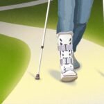 The Unexpected Way to Heal a Broken Bone