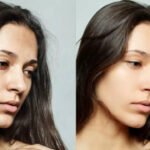 Tanning or dark spots? How to tell what your skin is actually dealing with